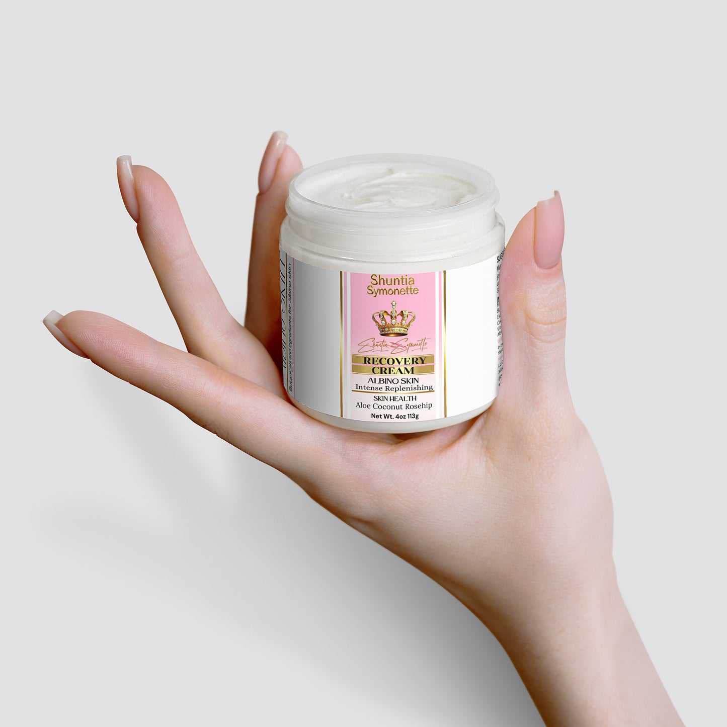 Recovery Cream For Albino Skin - Shuntia Symonette