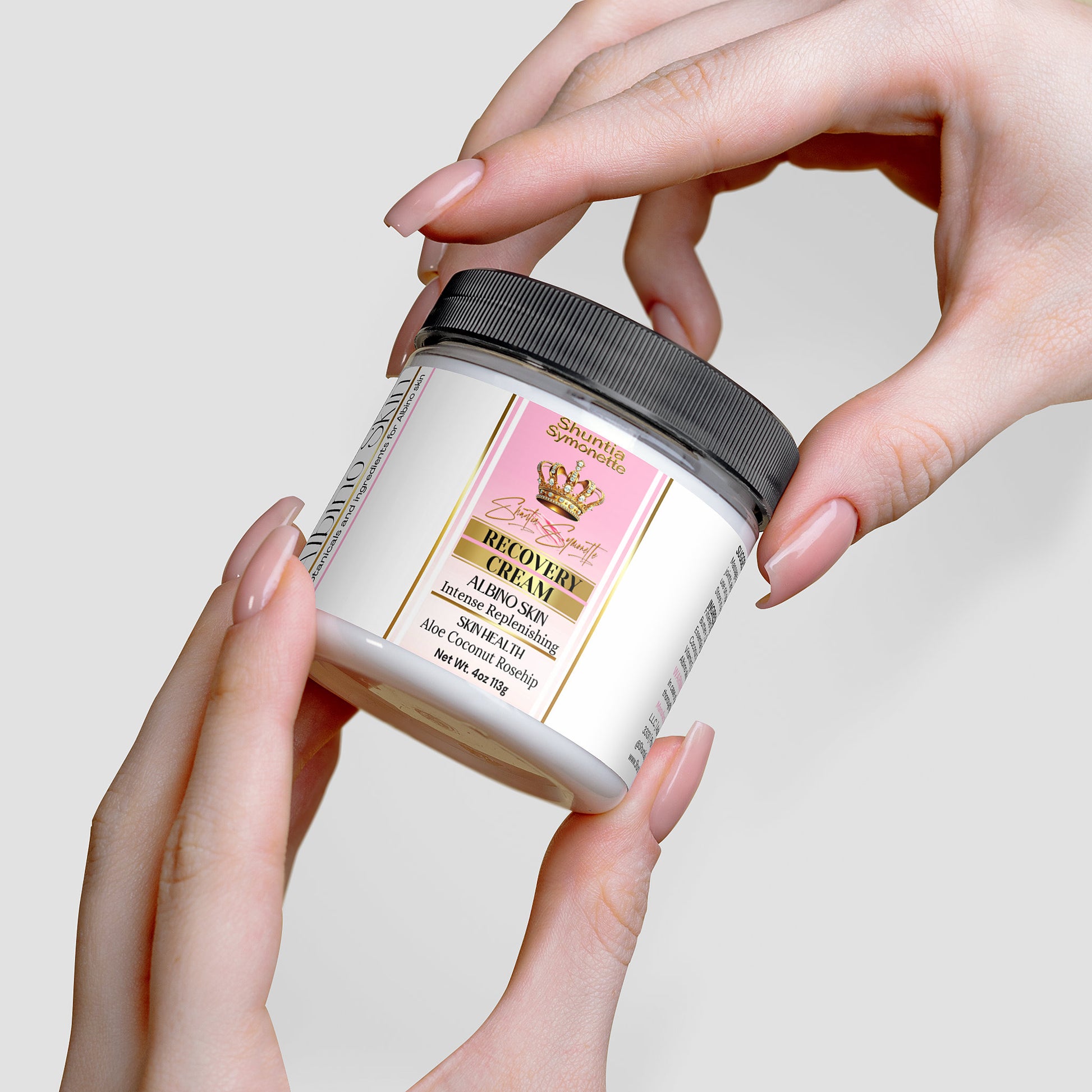 Recovery Cream For Albino Skin - Shuntia Symonette