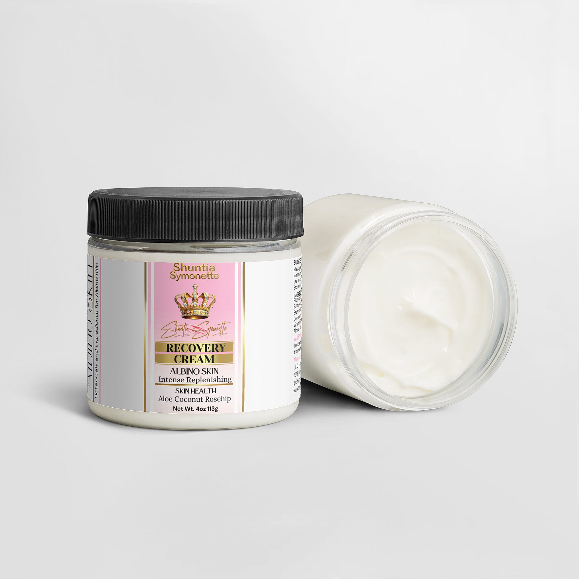 Recovery Cream For Albino Skin - Shuntia Symonette