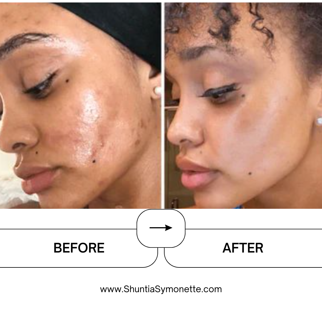HydraSnail Mucin Essence For Almond Skin hydration cream