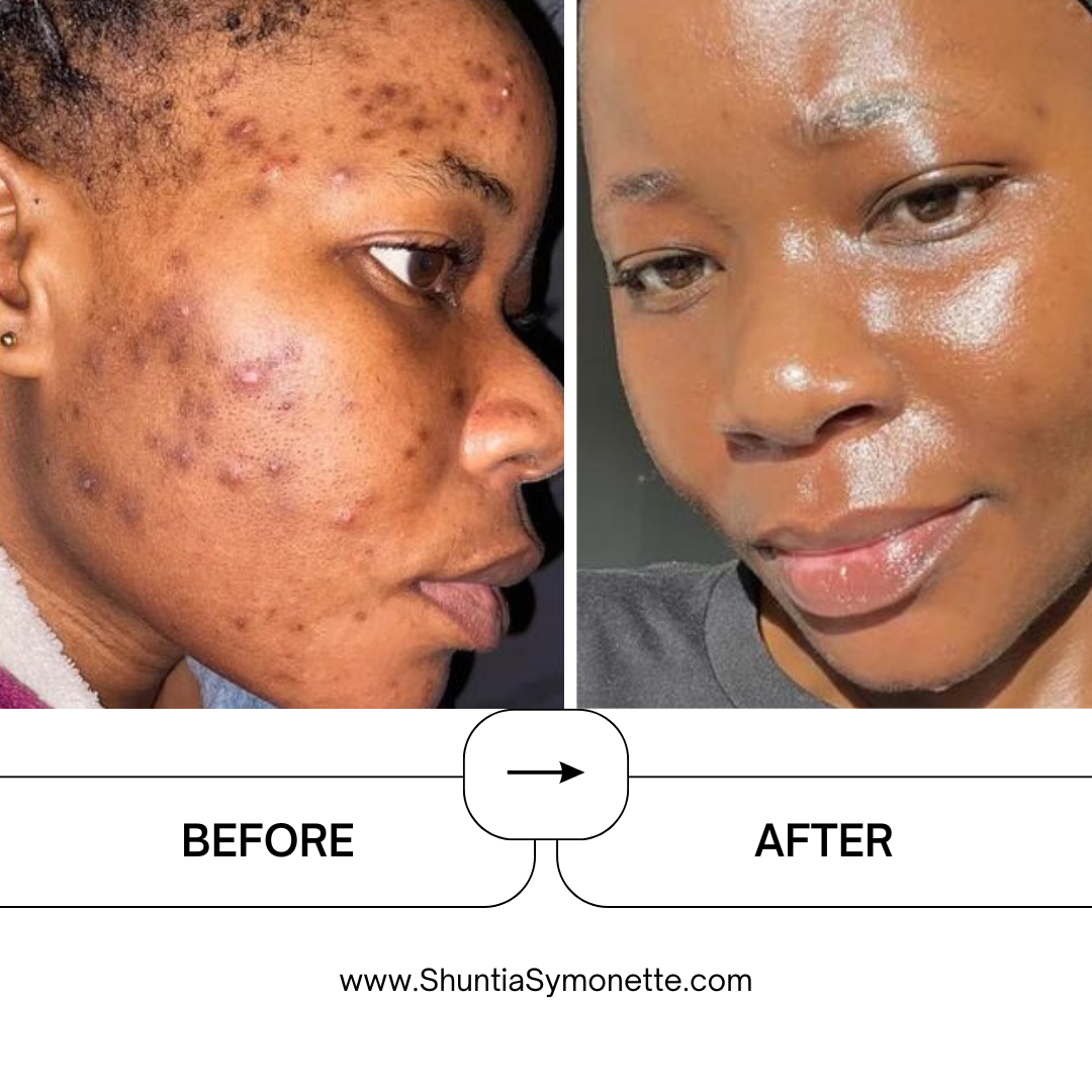 Pro-Aging Nourishing Face Cream For Melanin Skin