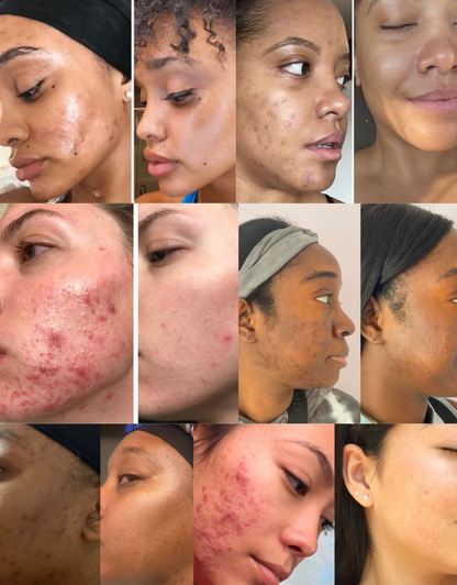 Whipped Grass-Fed Tallow Balm with Vanilla Bean - Shuntia Symonette