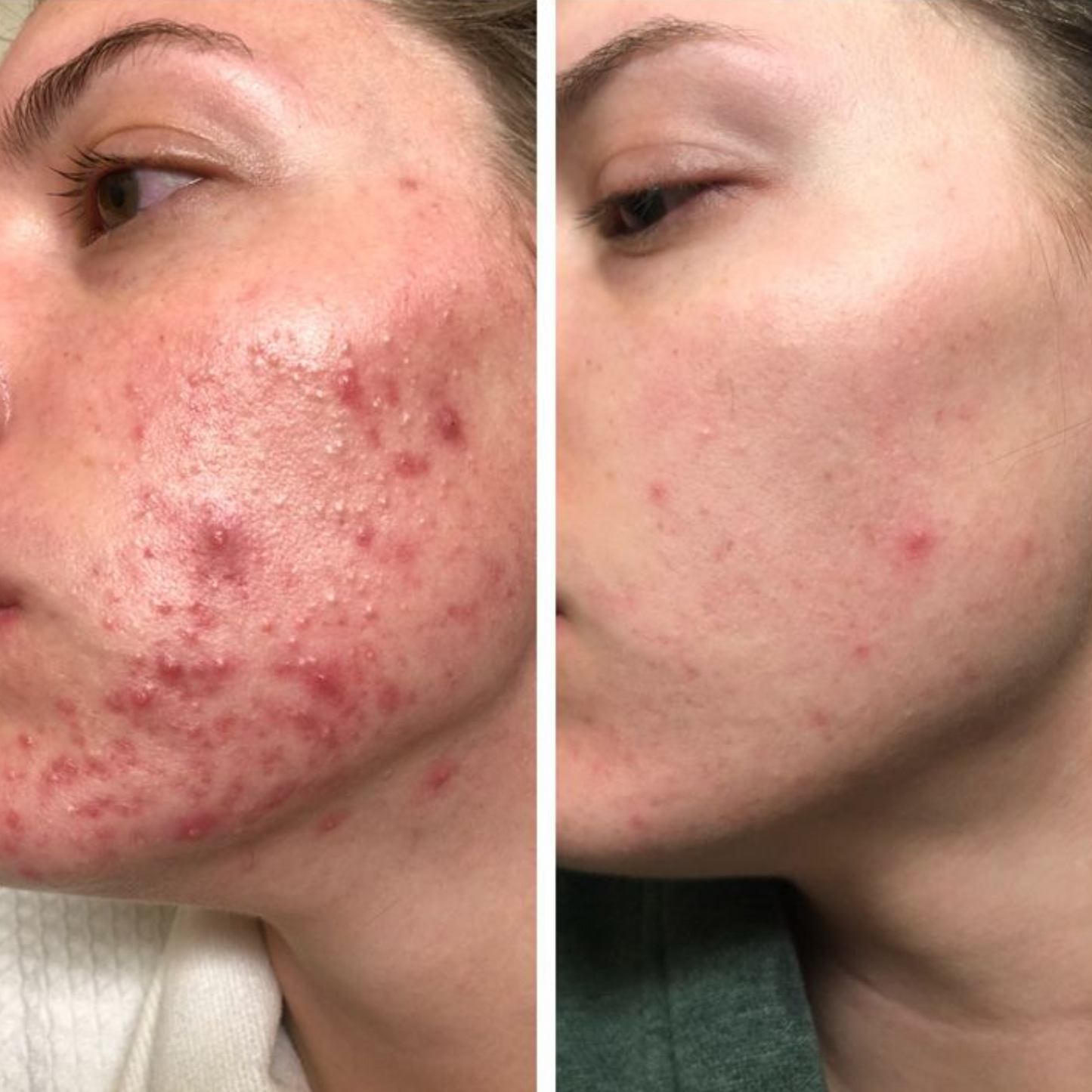 Recovery Cream - Shuntia Symonette