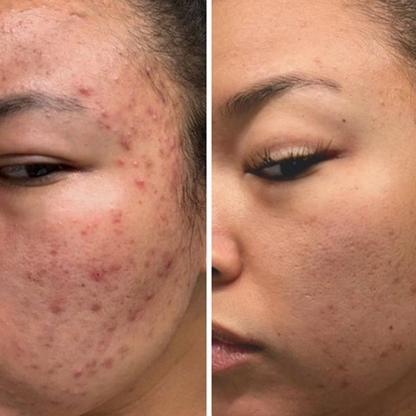 Pro Aging Nourishing Face Cream - Shuntia Symonette