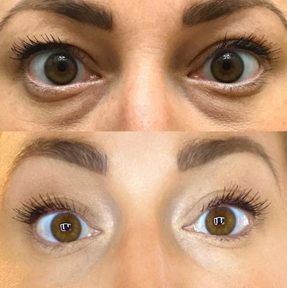 Brighten Firm Eye Serum Intensive Renewal dark circle corrector firming eye treatment collagen boost anti aging skincare under eye tightening glass skin luxury beauty routine trending viral formula by Shuntia Symonette shop the viral trending product on amazon etsy google facebook Instagram TikTok shopify youtube pineterest shop