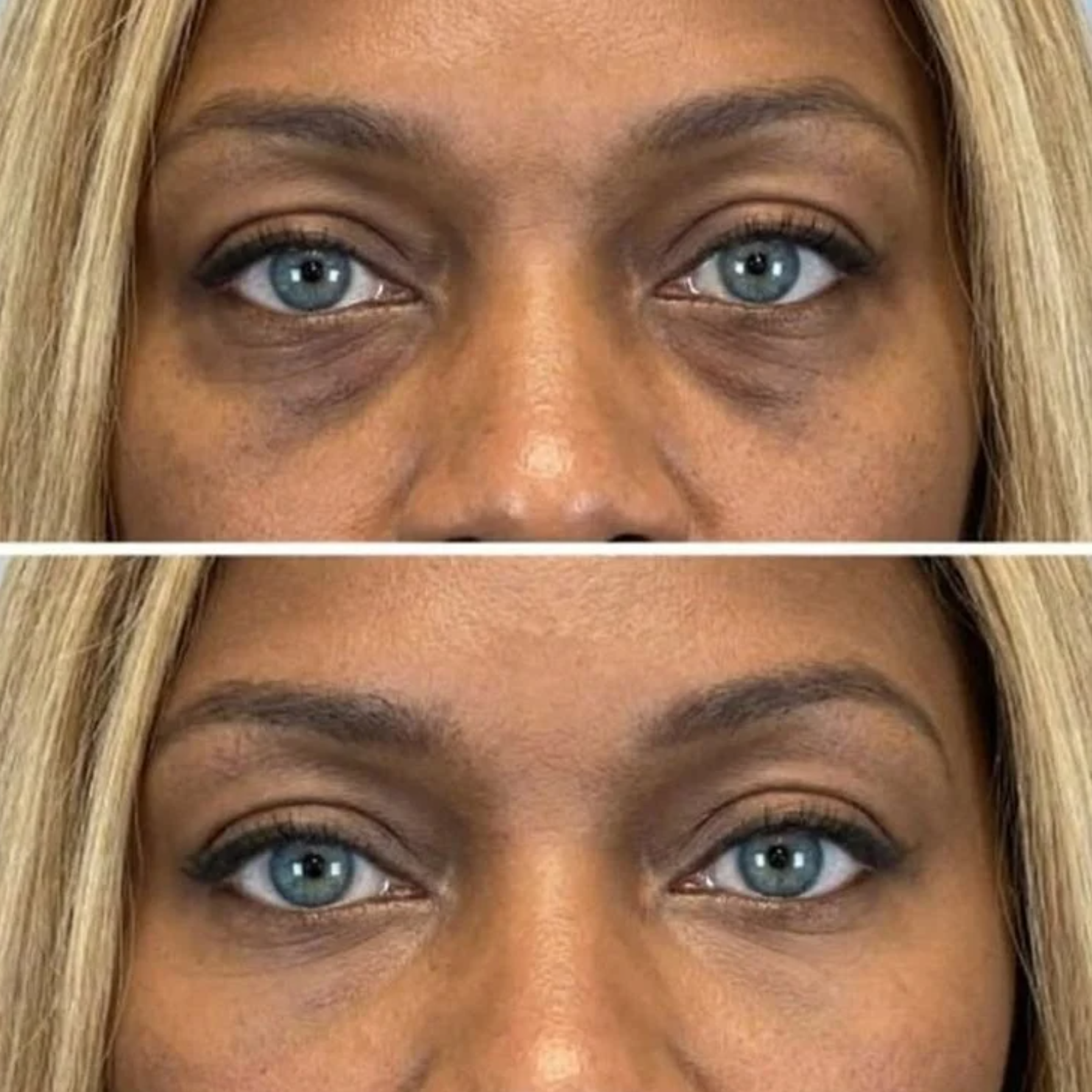 Brighten Firm Eye Serum Intensive Renewal dark circle corrector firming eye treatment collagen boost anti aging skincare under eye tightening glass skin luxury beauty routine trending viral formula by Shuntia Symonette shop the viral trending product on amazon etsy google facebook Instagram TikTok shopify youtube pineterest shop