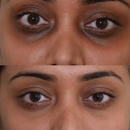 Brighten Firm Eye Serum Intensive Renewal dark circle corrector firming eye treatment collagen boost anti aging skincare under eye tightening glass skin luxury beauty routine trending viral formula by Shuntia Symonette shop the viral trending product on amazon etsy google facebook Instagram TikTok shopify youtube pineterest shop