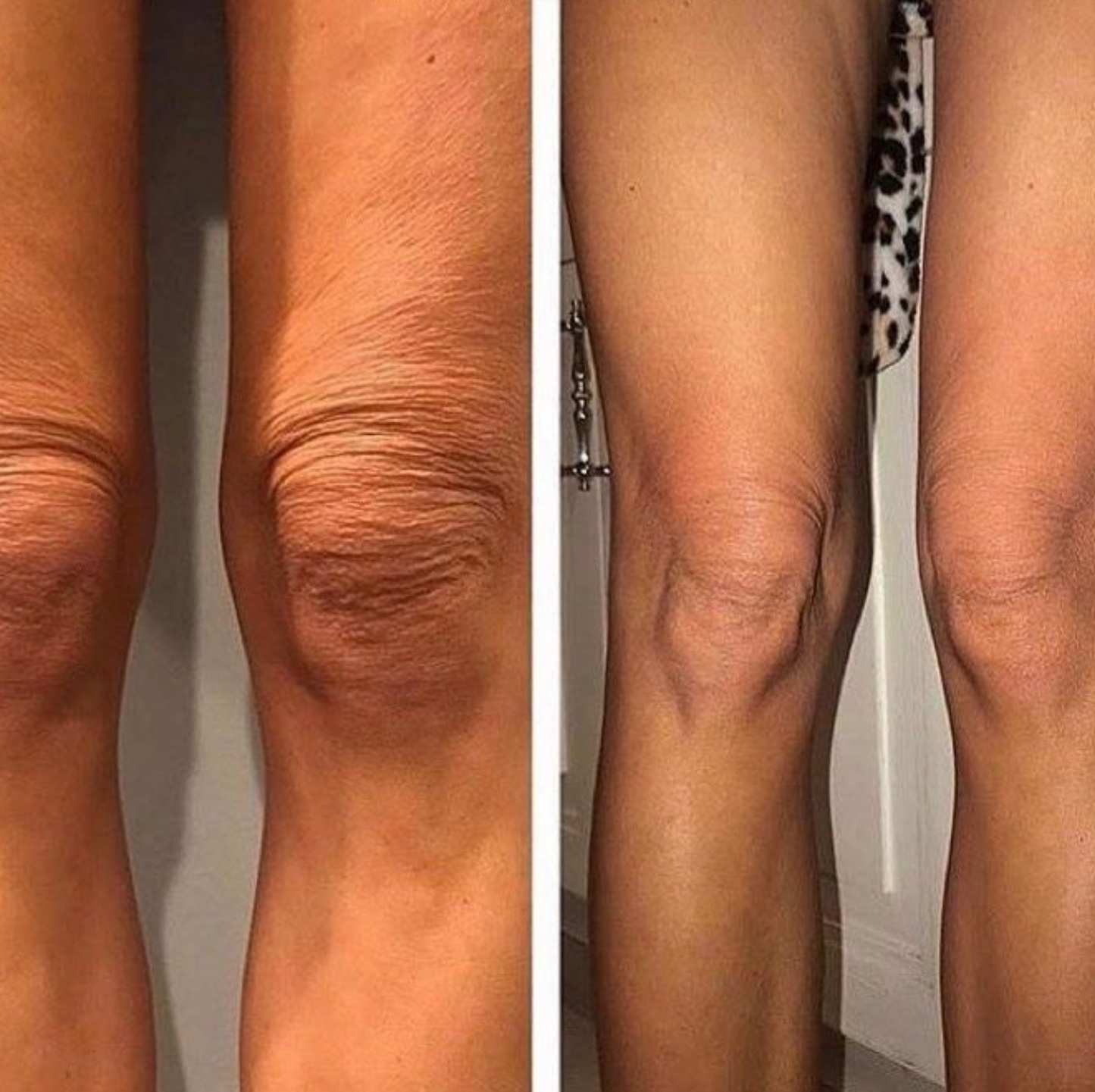 Body Sculpt Firming Toning Contouring cream cellulite smoothing skin tightening body contour sculpting firming treatment luxury body care routine viral trending beauty wellness formula by Shuntia Symonette shop the viral trending product on amazon etsy google facebook Instagram TikTok shopify youtube pineterest shop fenty skims loreal mac chanel nike addidas beyonce taylor swift rihanna mariah cardi b nicki minaj tyla 