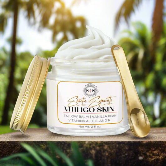 Whipped Tallow Balm with Vanilla Bean For Vitiligo Skin
